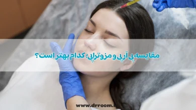 مقایسه پی آر پی و مزوتراپی؛ کدام بهتر است؟