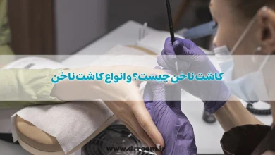 کاشت ناخن چیست؟ و انواع کاشت ناخن