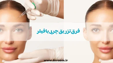 فرق تزریق چربی با فیلر؛ کدام بهتر است؟
