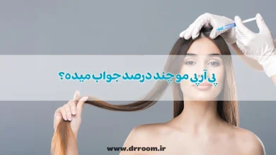 پی آر پی مو چند درصد جواب میده؟