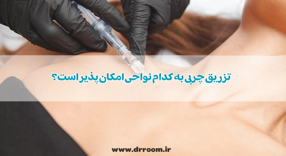 تزریق چربی به کدام نواحی امکان پذیر است؟