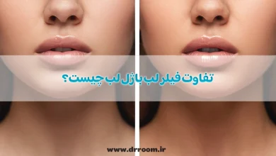 تفاوت فیلر لب با ژل لب چیست؟