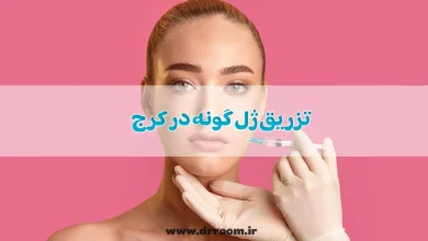 تزریق ژل گونه در کرج