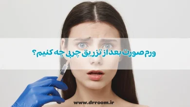 برای کم شدن ورم صورت بعد از تزریق چربی چه کنیم؟