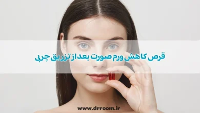 قرص کاهش ورم صورت بعد از تزریق چربی