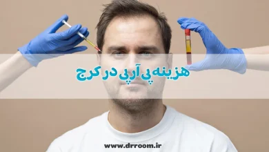 هزینه پی آر پی در کرج