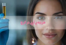 هزینه پی آر پی در کرج
