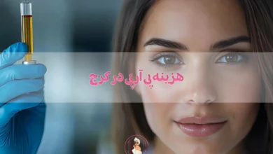 هزینه پی آر پی در کرج