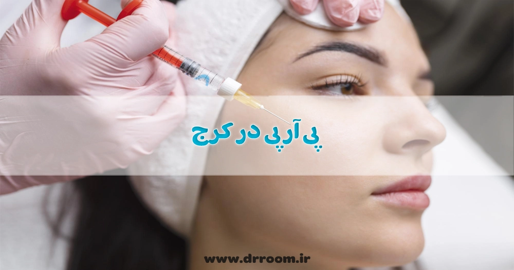 پی آر پی در کرج