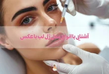 آشنایی با انواع مدل ژل لب با عکس
