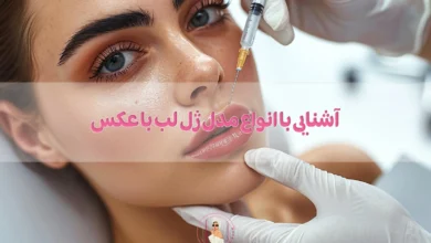 آشنایی با انواع مدل ژل لب با عکس
