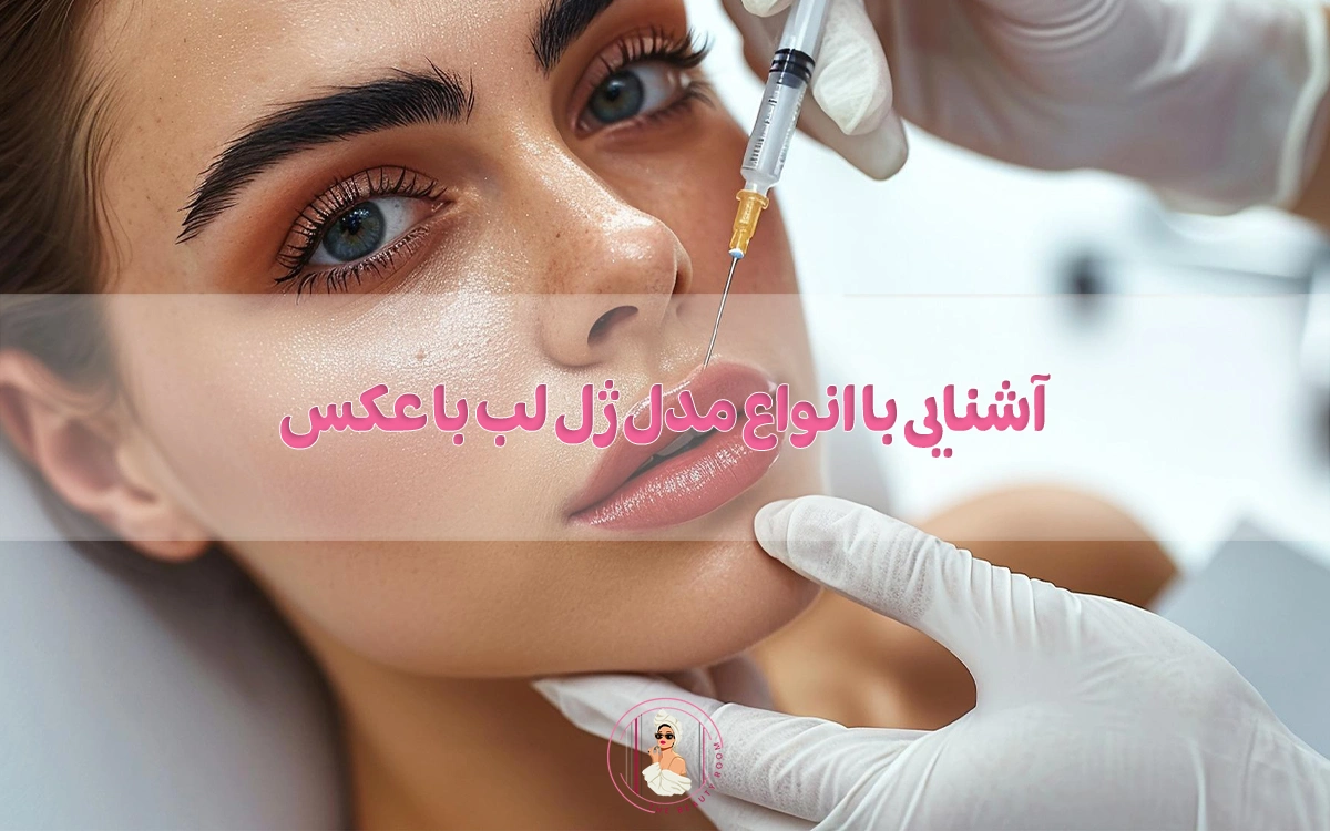 آشنایی با انواع مدل ژل لب با عکس