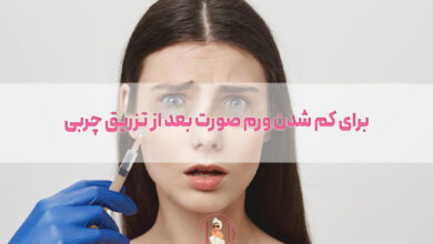 برای کم شدن ورم صورت بعد از تزریق چربی چه کنیم؟