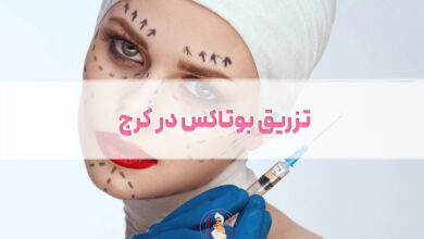تزریق بوتاکس در کرج