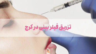 تزریق فیلر بینی در کرج