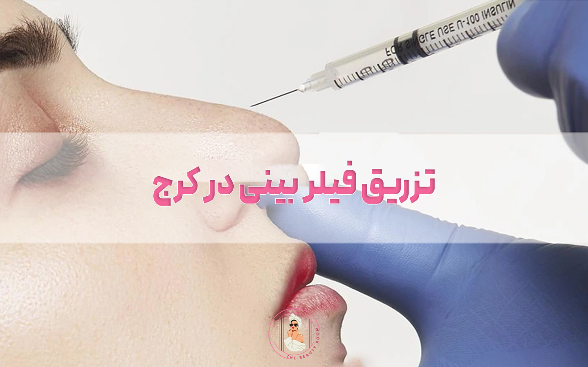تزریق فیلر بینی در کرج