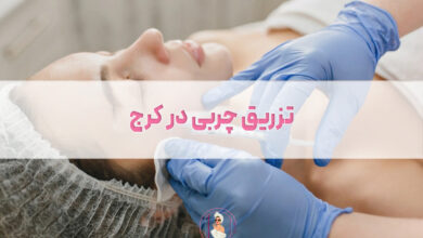 تزریق چربی در کرج