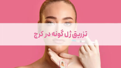 تزریق ژل گونه در کرج