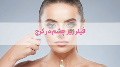 فیلر زیر چشم در کرج