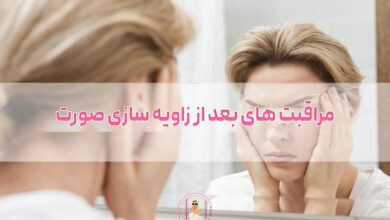 مراقبت های بعد از زاویه سازی صورت