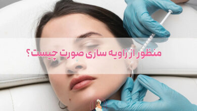 منظور از زاویه سازی صورت چیست؟