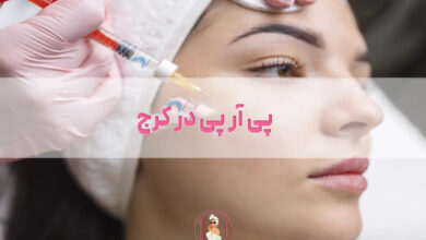 پی آر پی در کرج