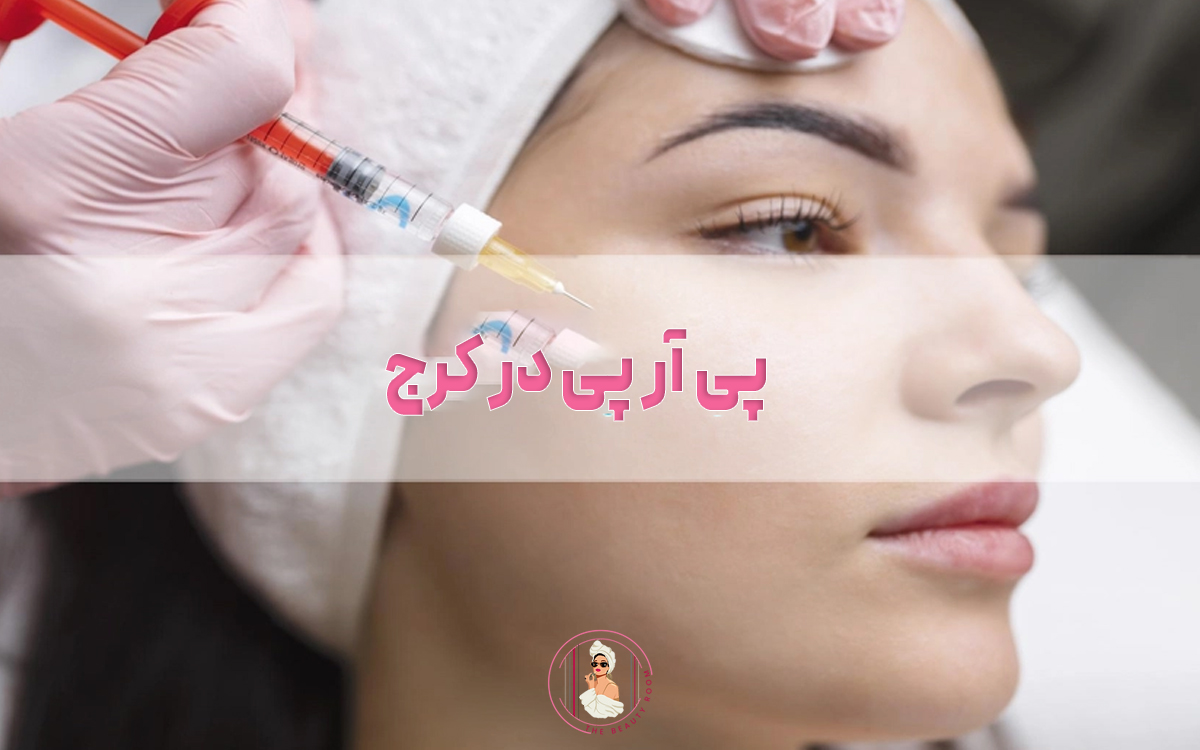 پی آر پی در کرج