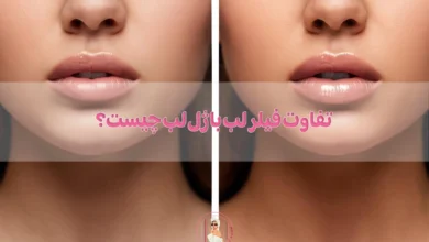 تفاوت فیلر لب با ژل لب چیست؟