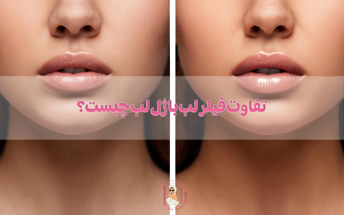 تفاوت فیلر لب با ژل لب چیست؟