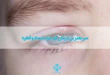 سریعترین درمان گل مژه