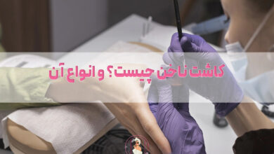 کاشت ناخن چیست؟ و انواع کاشت ناخن