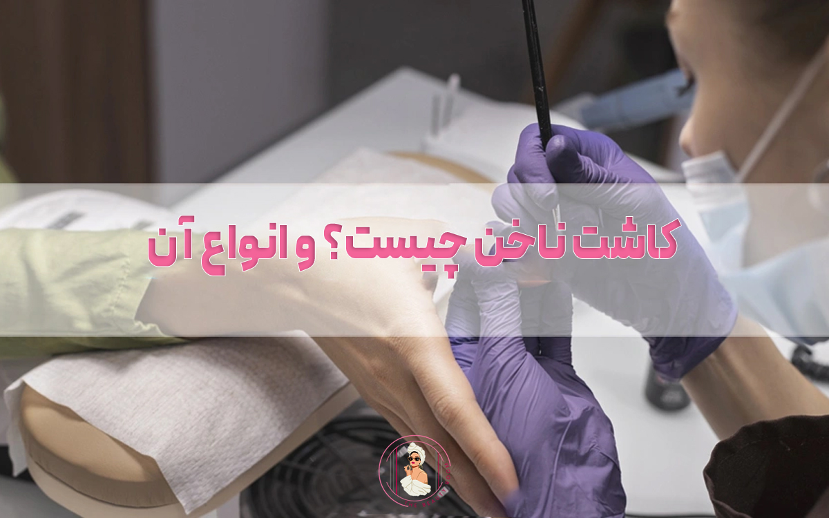 کاشت ناخن چیست؟ و انواع کاشت ناخن