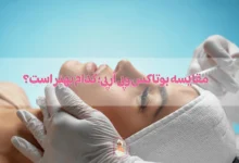 مقایسه بوتاکس و پی آر پی؛کدام بهتر است؟