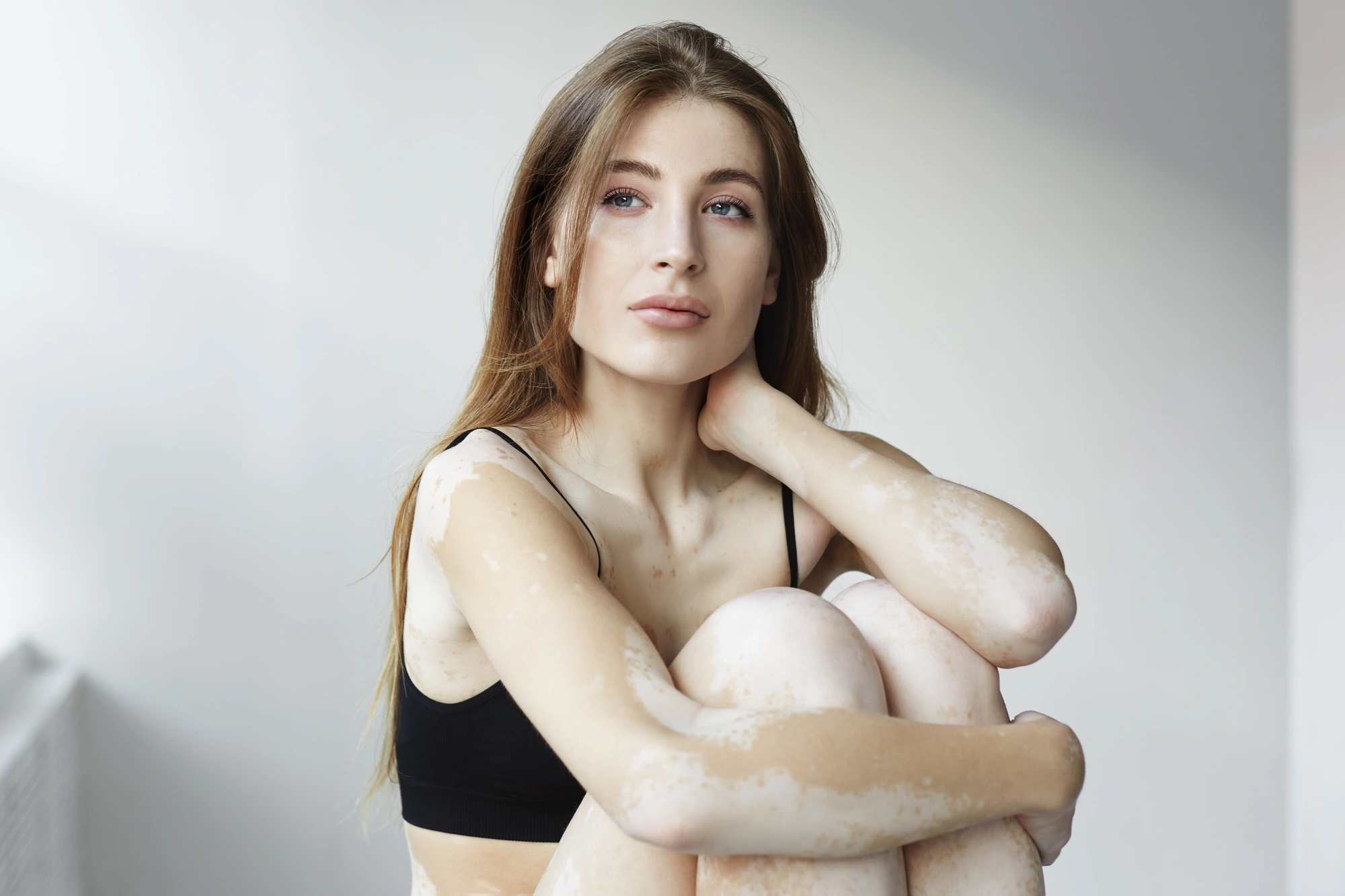 چه زمانی به پزشک متخصص پوست مراجعه کنیم؟
