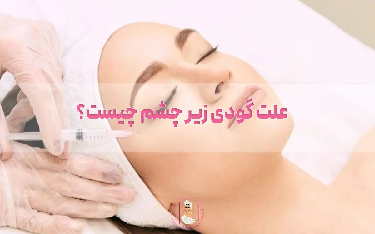 علت گودی زیر چشم چیست؟