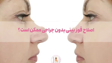 اصلاح قوز بینی بدون جراحی ممکن است؟