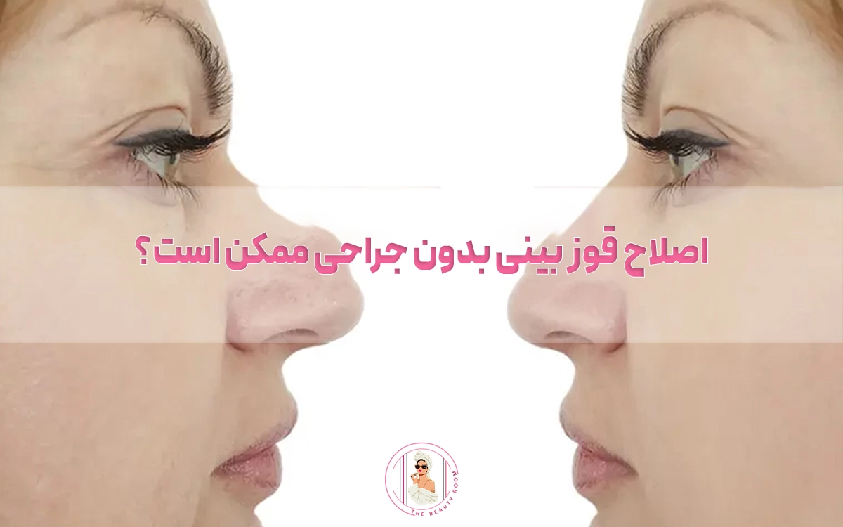 اصلاح قوز بینی بدون جراحی ممکن است؟