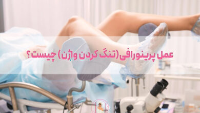 عمل-پرینورافی(تنگ-کردن-واژن)-چیست؟