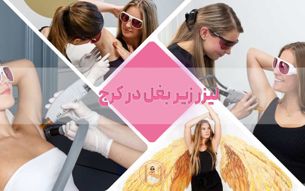 لیزر زیر بغل در کرج