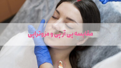مقایسه پی آر پی و مزوتراپی؛ کدام بهتر است؟
