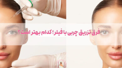 فرق تزریق چربی با فیلر؛ کدام بهتر است؟