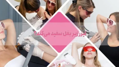 رفع تیرگی زیر بغل