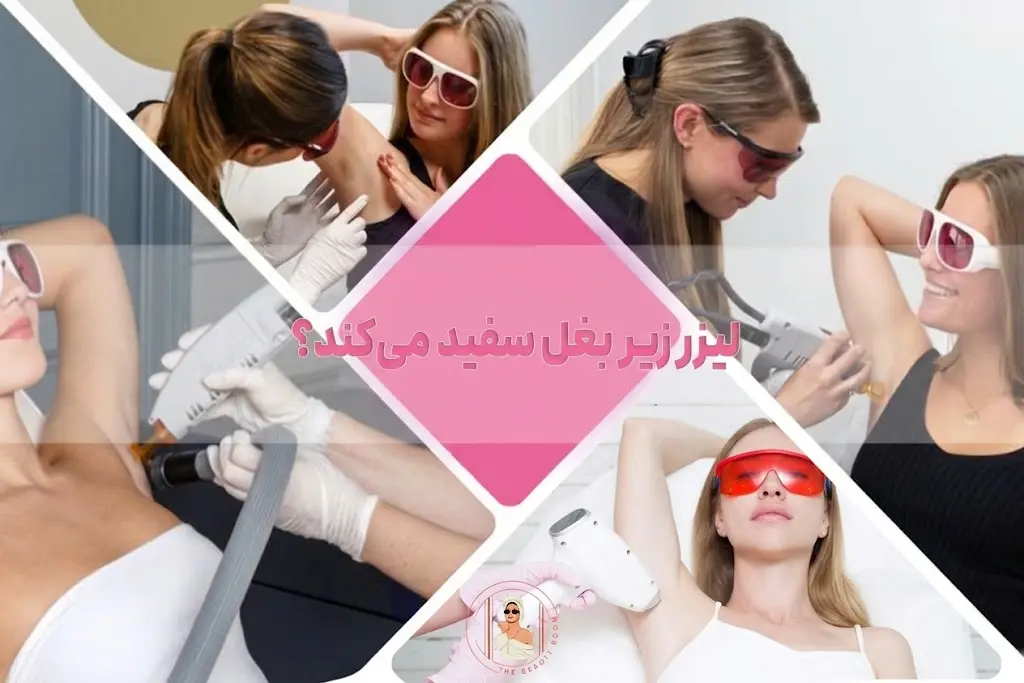 رفع تیرگی زیر بغل