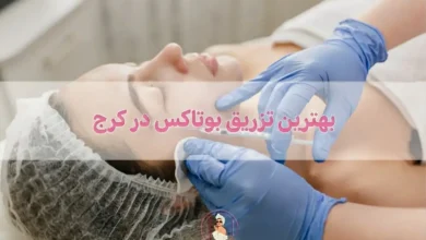 بهترین تزریق بوتاکس در کرج