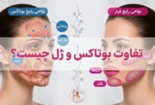 تفاوت بوتاکس و ژل