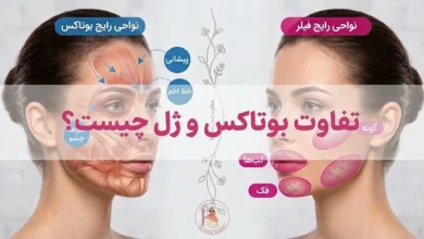 تفاوت بوتاکس و ژل