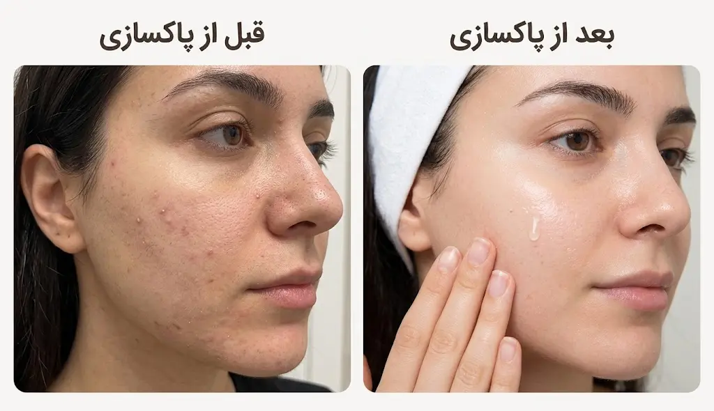 مقایسه درمان پوست کدر صورت