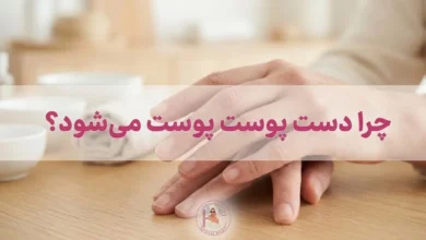 علت پوست پوست شدن دست ها چیست؟